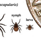 Illustration for article titled Did You Know Getting Bit By A Tick Could Paralyze Your Face?